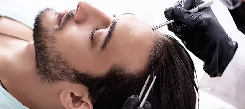 Affordable Hair Transplant Istanbul – Sapphire Hair Clinic